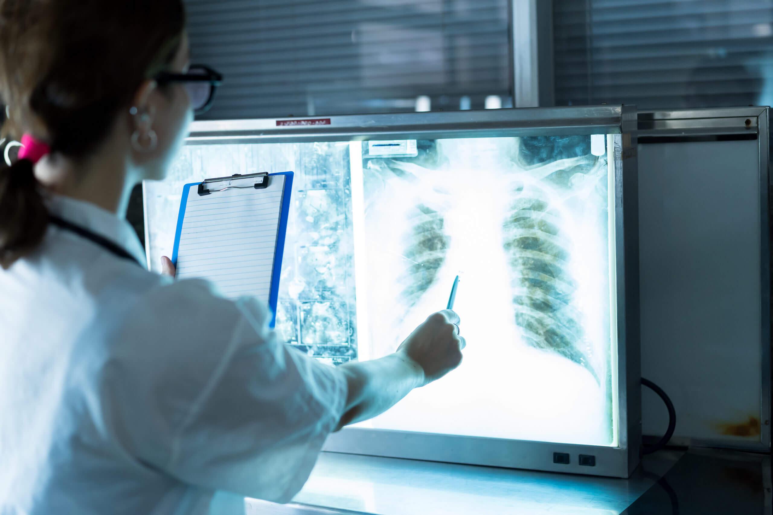 Female doctor checking anatomy and physiology x-ray film of patient in the hospital