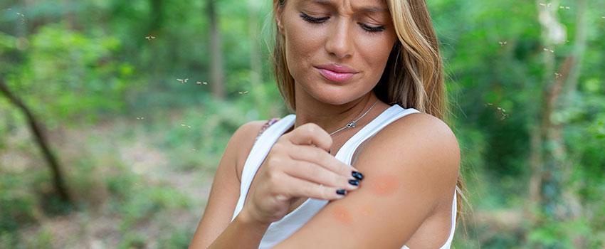 Do All Bug Bites Look Different?