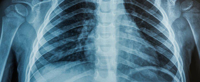 Does AFC Offer X-Ray Services?