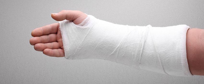 Do I Need to Treat a Fracture?