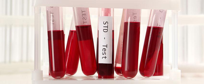 Do I Need to Come in for an STD Test Regularly?