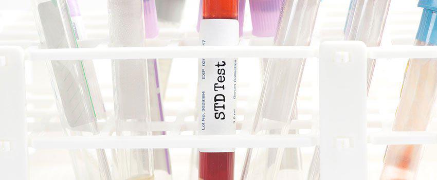 How Common Are STDs in the United States?