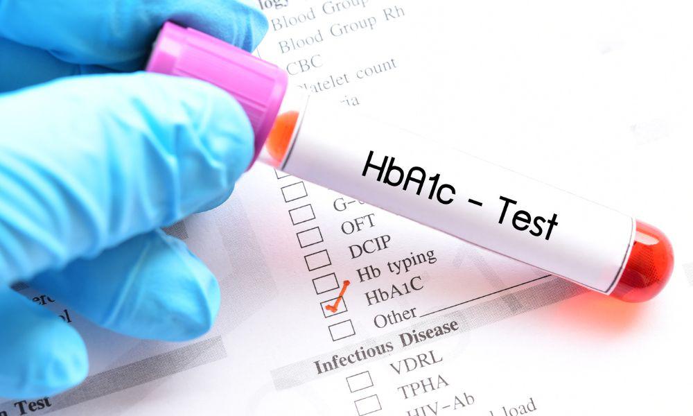 A Brief Guide to A1C: Everything You Need To Know