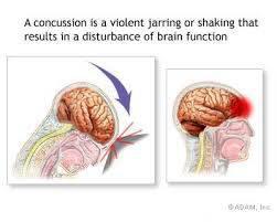 What You Need to Know About Concussions and Head Trauma