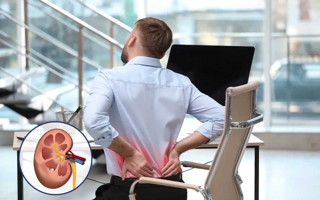 What Causes Kidney Stones?