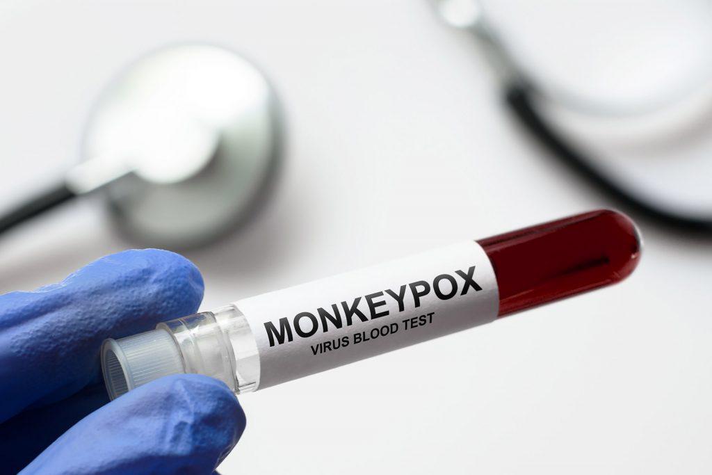 Monkeypox Testing and Treatment at AFC