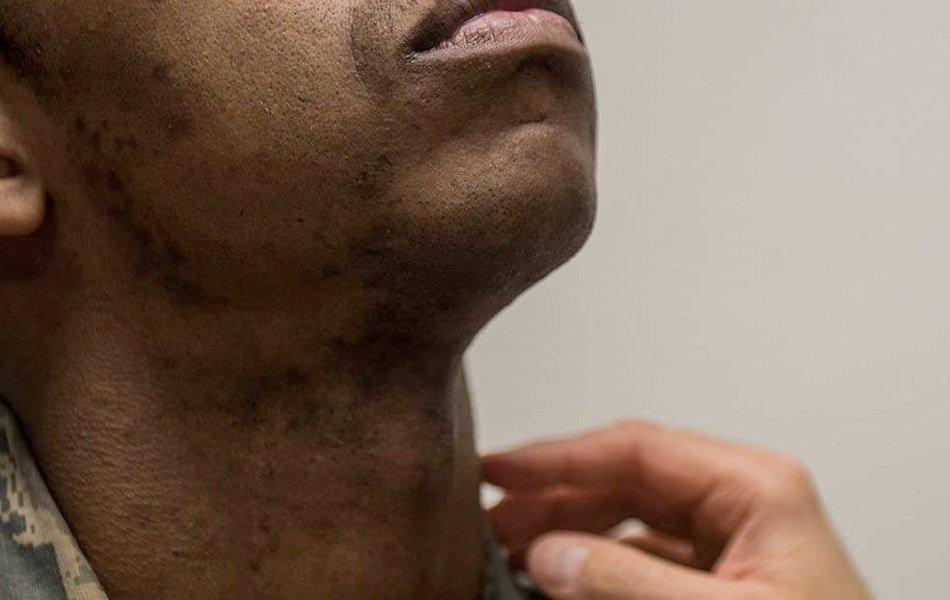 Could My Sore Throat Be Strep?