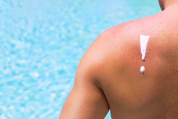 Heat Rash Symptoms and Treatment