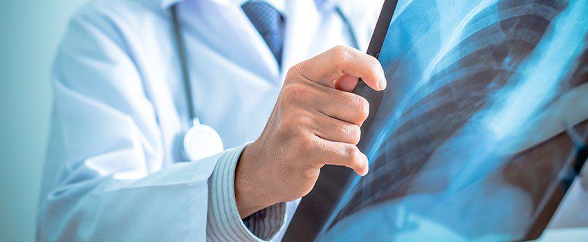 When Do I Need an X-ray for My Injury?