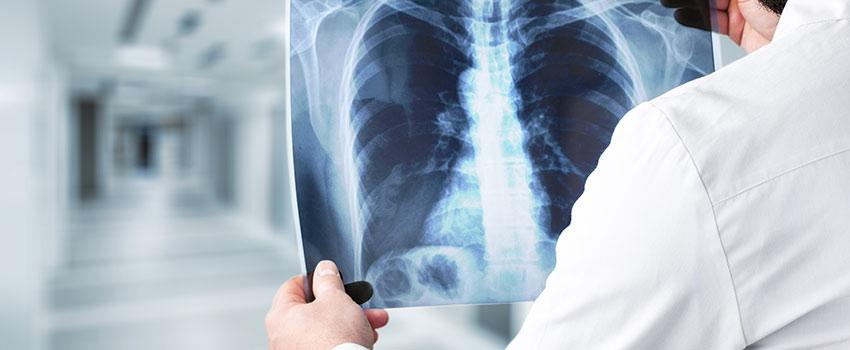 Should I Be Worried About Getting an X-ray?