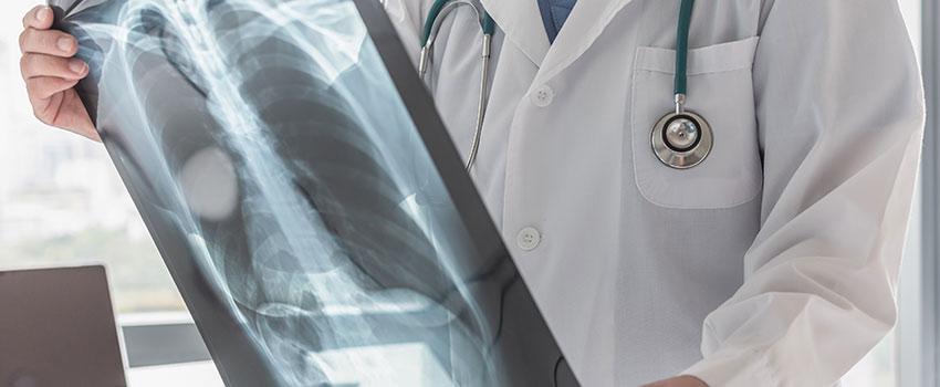 When Should I Get an X-ray?