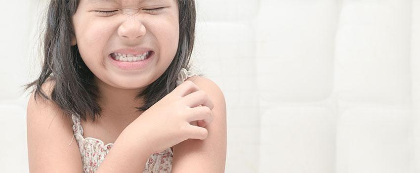 Is My Child’s Poison Ivy Rash a Cause for Concern?- AFC Urgent Care