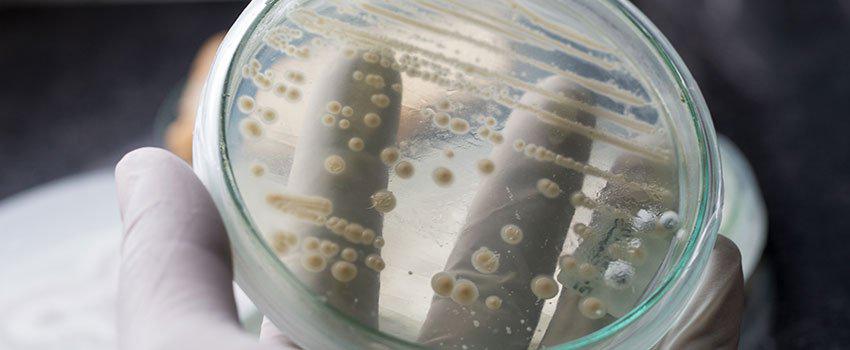 Can Yeast Infections Only Happen to Women?- AFC Urgent Care