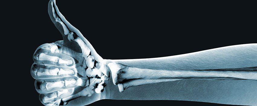 How to Tell if You Need an X-ray