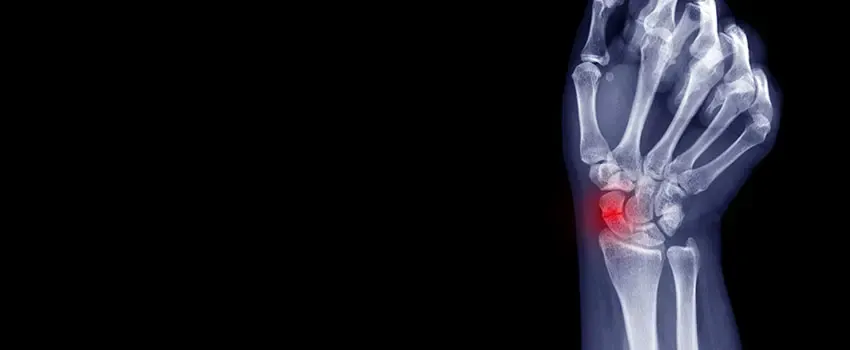 Can a Small Fracture Become Larger?