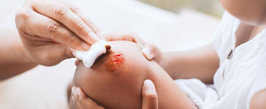 Should I Be Concerned That My Child Bruises a Lot? Should I Be Concerned That My Child Bruises a Lot?
