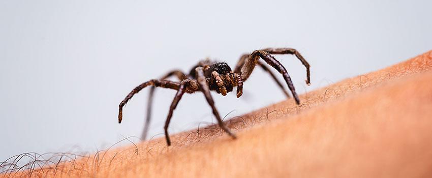 What Should I Do If a Spider Bites Me?