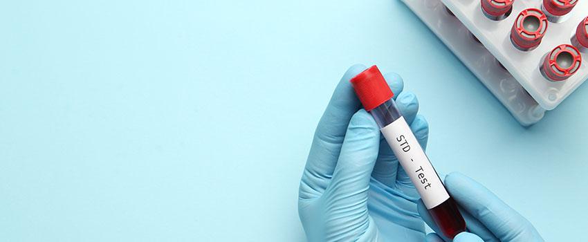 Will AFC Dalton Be Able to Test for and Treat STDs?