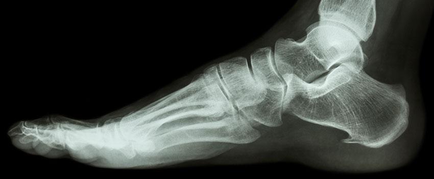 Does AFC Urgent Care Dalton Offer X-ray Services?