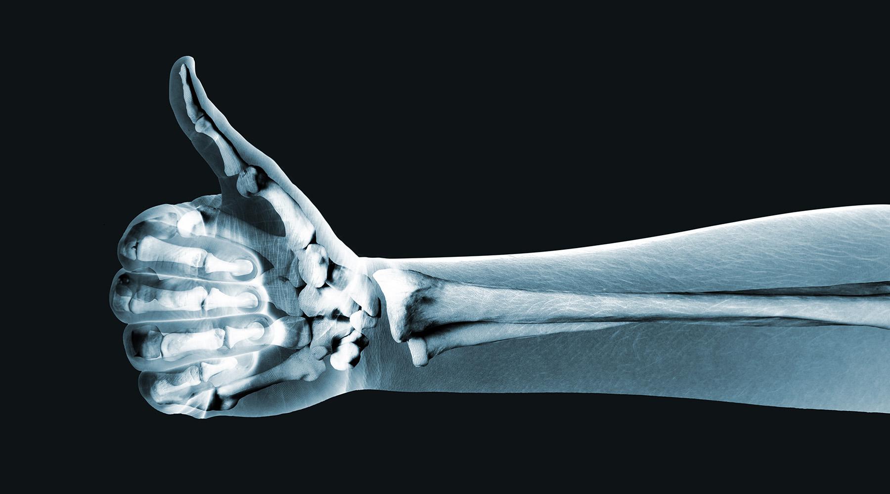 AFC’s Digital X-Ray Services