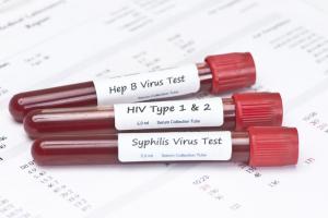 Let's face it. Thinking you might have an STD is scary. With just 29% of primary care doctors available to patients after-hours, you may panic at the thought of waiting to be tested. Luckily for you, there are more options available, such as urgent care services, that can test you when your doctor cannot. Here Let's face it. Thinking you might have an STD is scary. With just 29% of primary care doctors available to patients after-hours, you may panic at the thought of waiting to be tested. Luckily for you, there are more options available, such as urgent care services, that can test you when your doctor cannot. Here