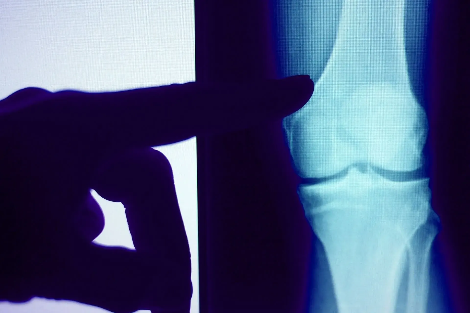 X-Rays at AFC Urgent Care